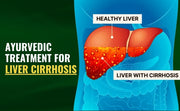 Ayurvedic Treatment for Liver Cirrhosis