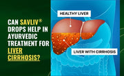 Can Savliv Drops Help in Ayurvedic Treatment for Liver Cirrhosis?