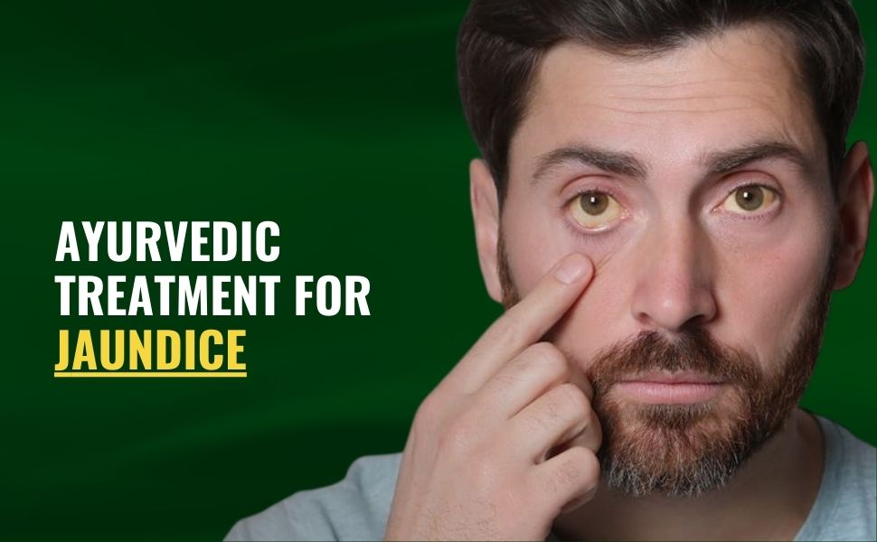 Ayurvedic Treatment for Jaundice