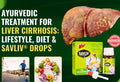 Ayurvedic Treatment for Liver Cirrhosis: Lifestyle, Diet & SAVLIV Drops
