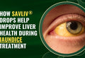 How Savliv Drops Help Improve Liver Health During Jaundice Treatment